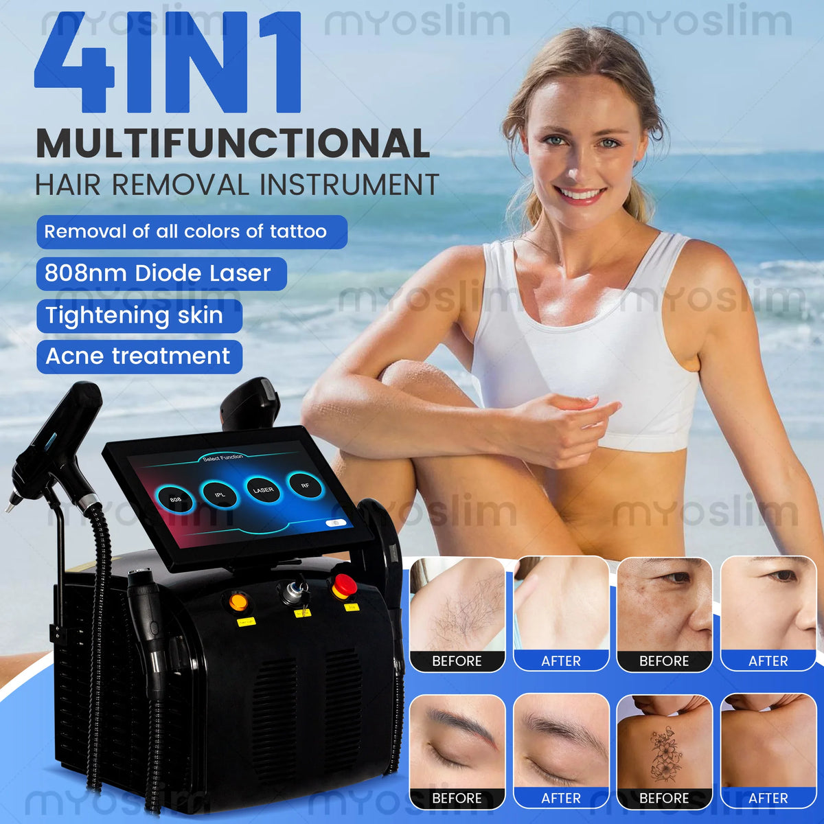 4 IN 1 Soprano Titanium Ice Platinum RF Diode 755 808 940 1064nm 4 Wave PICO Laser ND:YAG Painless Hair Removal Machine