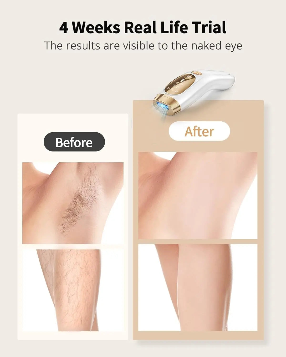 IPL Hair Removal Unlimited Flashes 9 Gears Ice-Cooling Painless Electric Depilator For Men Women Body Bikinis Intimate