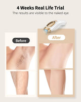 IPL Hair Removal Unlimited Flashes 9 Gears Ice-Cooling Painless Electric Depilator For Men Women Body Bikinis Intimate
