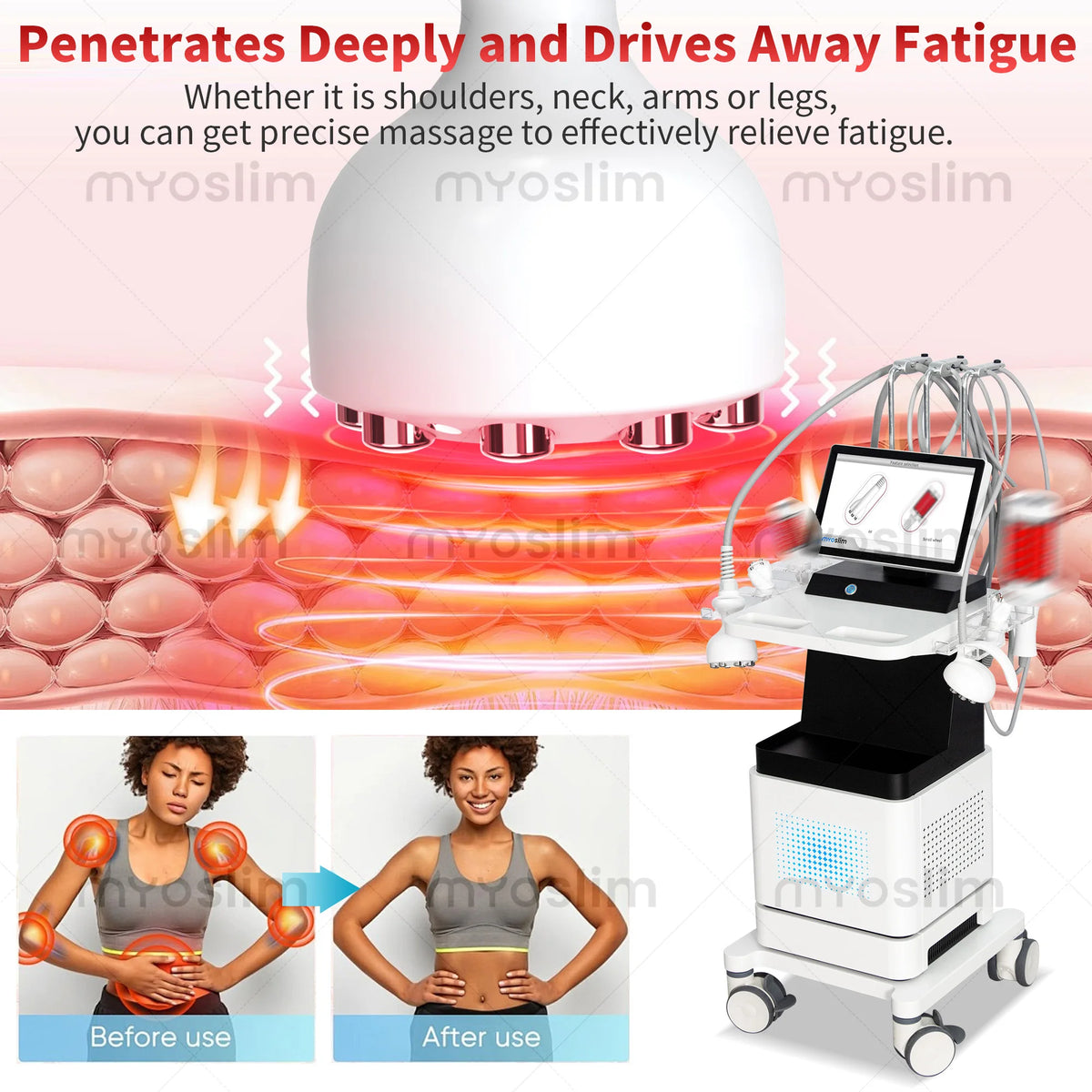 Venus Legacy RF Technology Slimming Machine 360 Degree Inner Ball Roller Body Fat Burning Skin Tightening Cellulite Device