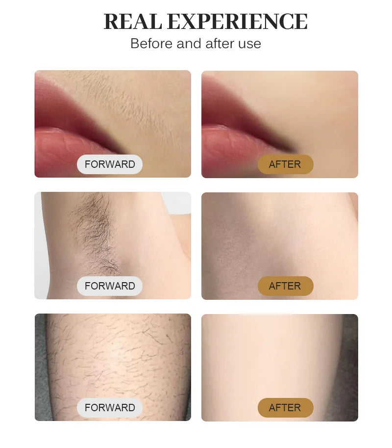 HOT Portable 4000W Diode Laser 10 Laser Bars 755NM 808NM 1064NM Wavelength Freezing Point Painless Permanent Hair Removal