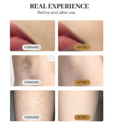 HOT Portable 4000W Diode Laser 10 Laser Bars 755NM 808NM 1064NM Wavelength Freezing Point Painless Permanent Hair Removal